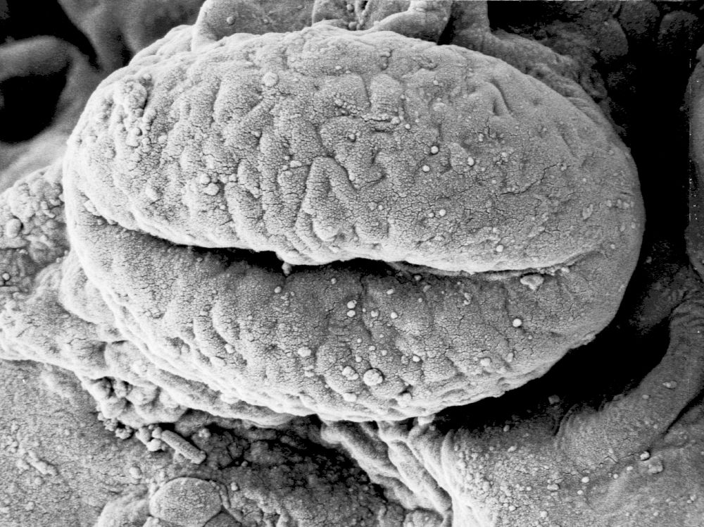 Hydrangeaceae Tylerianthus crossmanensis