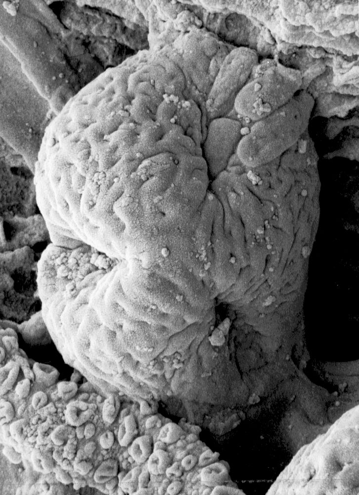 Hydrangeaceae Tylerianthus crossmanensis