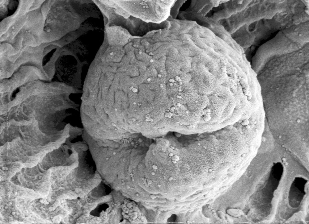 Hydrangeaceae Tylerianthus crossmanensis