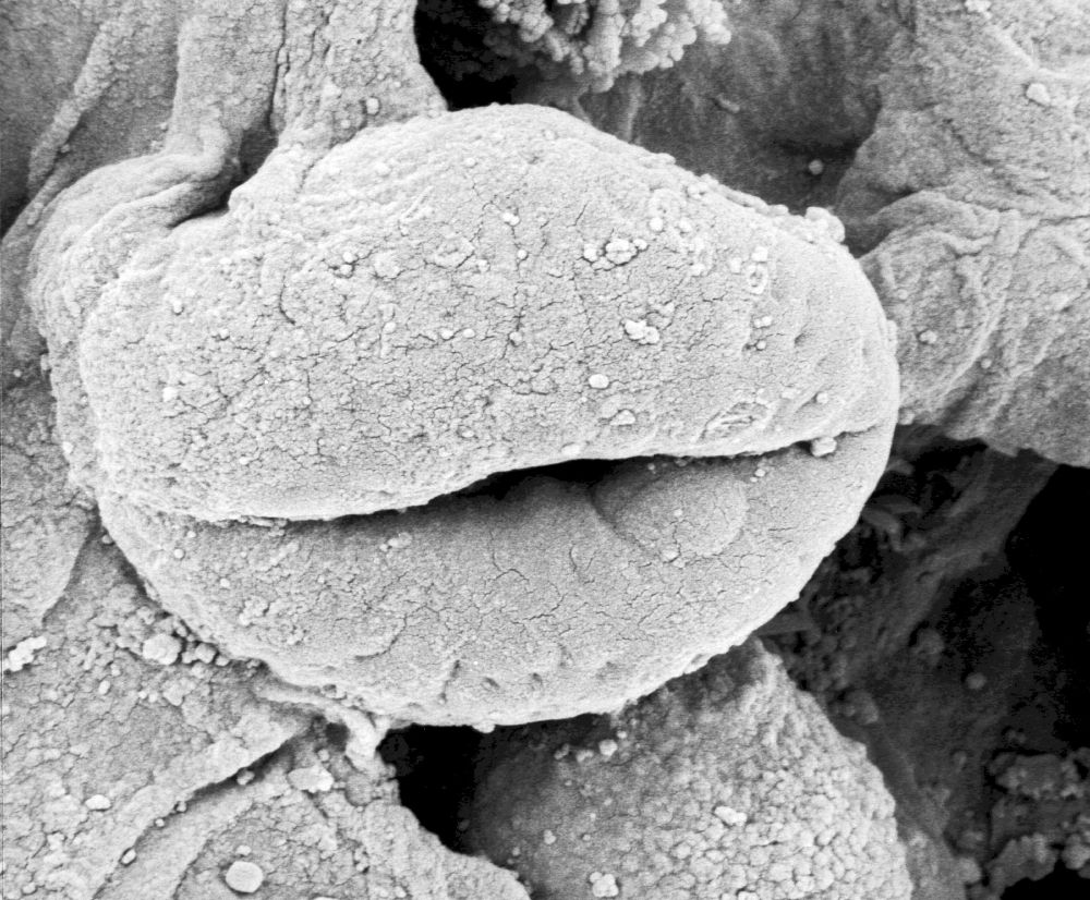 Hydrangeaceae Tylerianthus crossmanensis