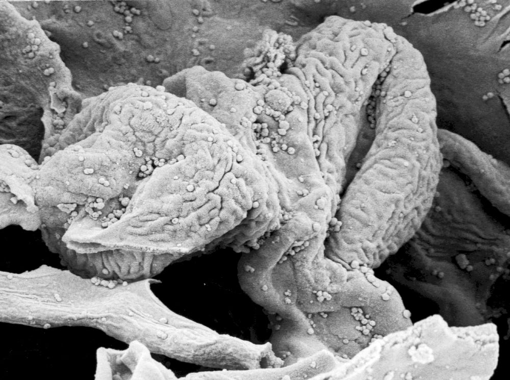 Hydrangeaceae Tylerianthus crossmanensis