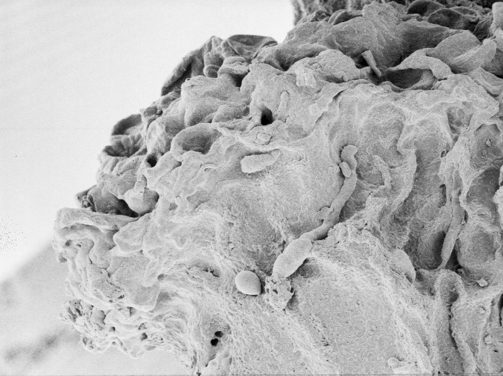 Hydrangeaceae Tylerianthus crossmanensis