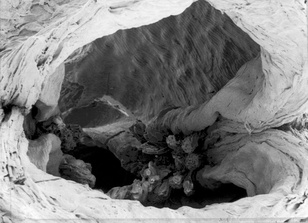 Hydrangeaceae Tylerianthus crossmanensis