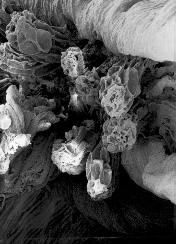 Hydrangeaceae Tylerianthus crossmanensis