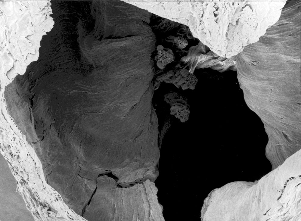 Hydrangeaceae Tylerianthus crossmanensis