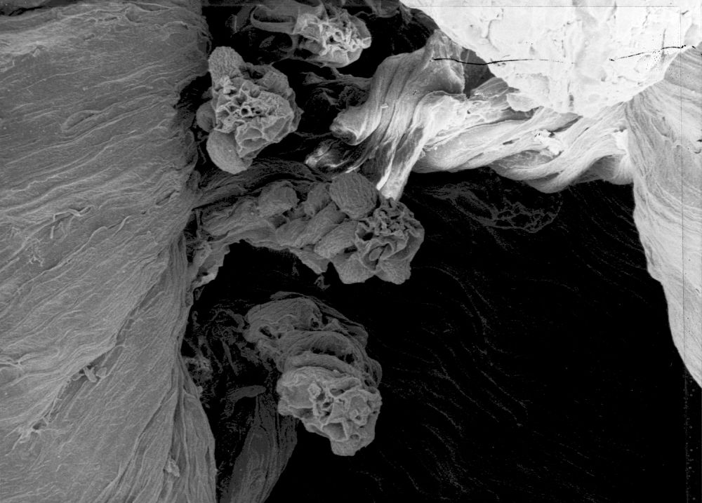 Hydrangeaceae Tylerianthus crossmanensis