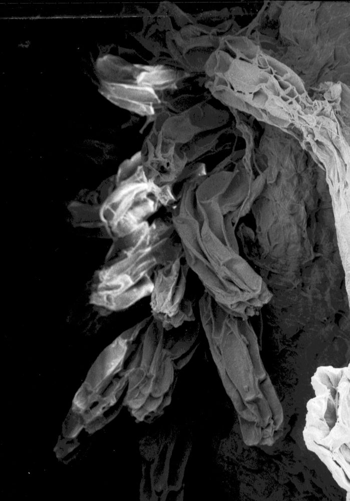 Hydrangeaceae Tylerianthus crossmanensis