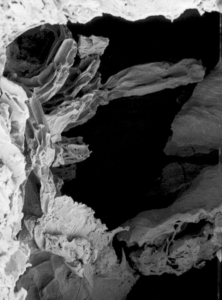 Hydrangeaceae Tylerianthus crossmanensis