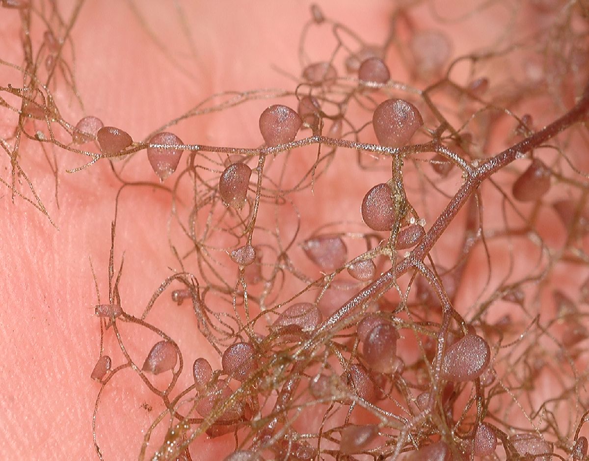 Lentibulariaceae Utricularia 