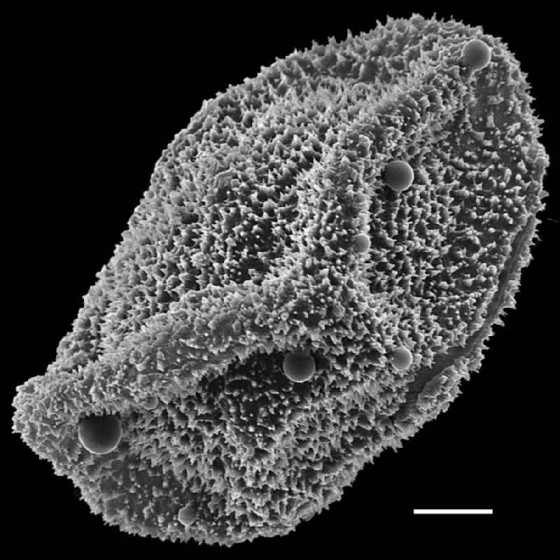 Lomariopsidaceae Arthrobotrya articulata