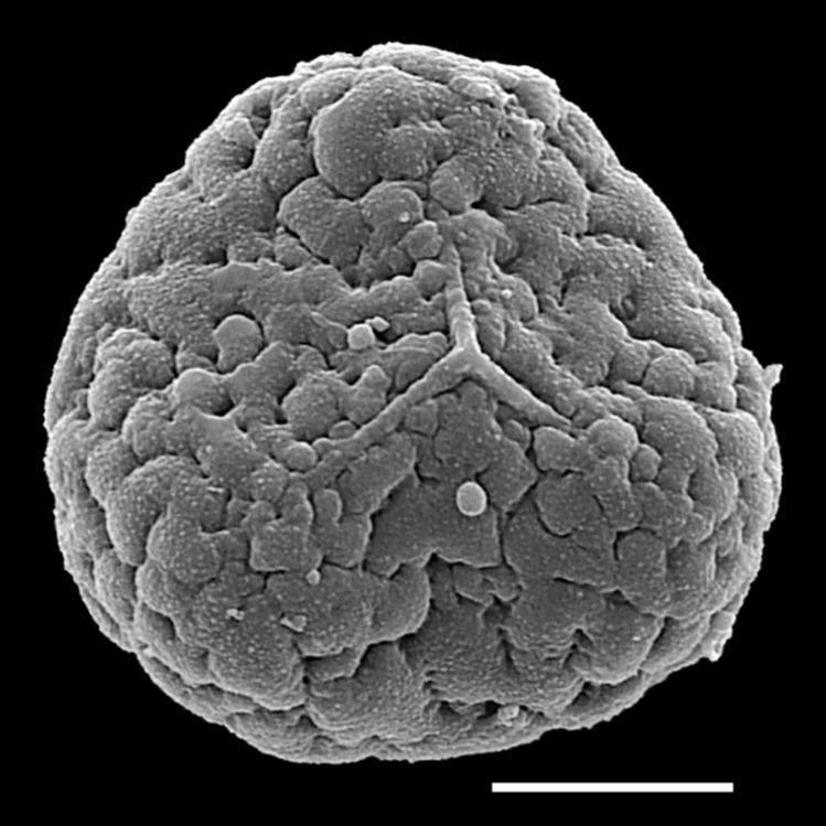 Ophioglossaceae Botrychium onodagense