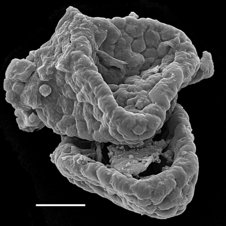 Ophioglossaceae Botrychium onodagense